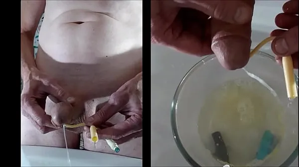 HD catheter insertion 에너지 영화